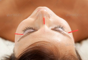 cosmetic-acupuncture-sm